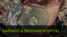 Harvard & Bigham Hospital: Plaque