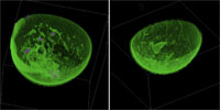 Volumetrisches Rendering des TechniScan Ganzbrust-Ultraschallsystems (WBU).