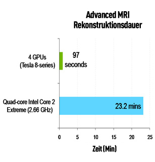 MRI Chart